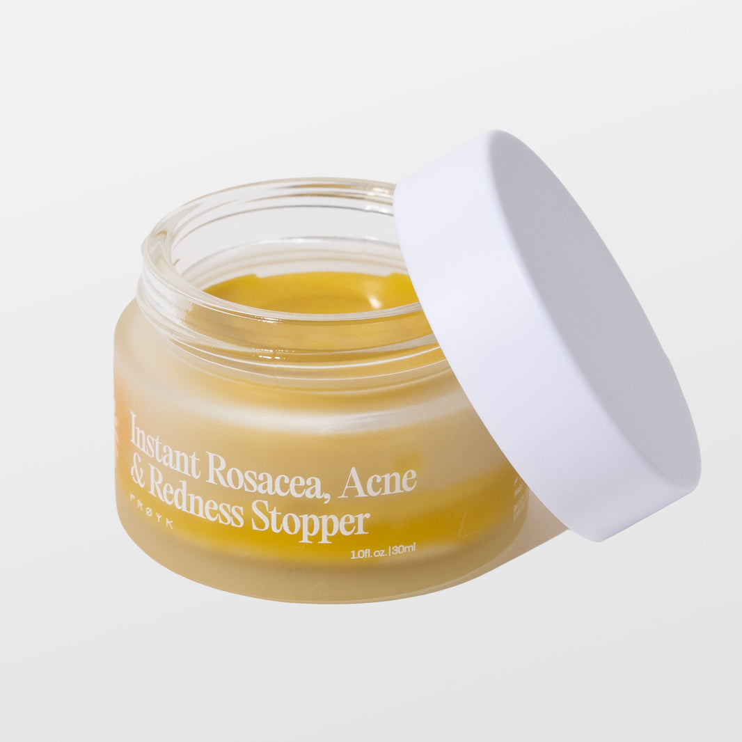 Acne Breakouts – Froya Organics